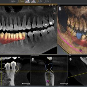 Dentsply Sirona - SiCAT Implant 2.0