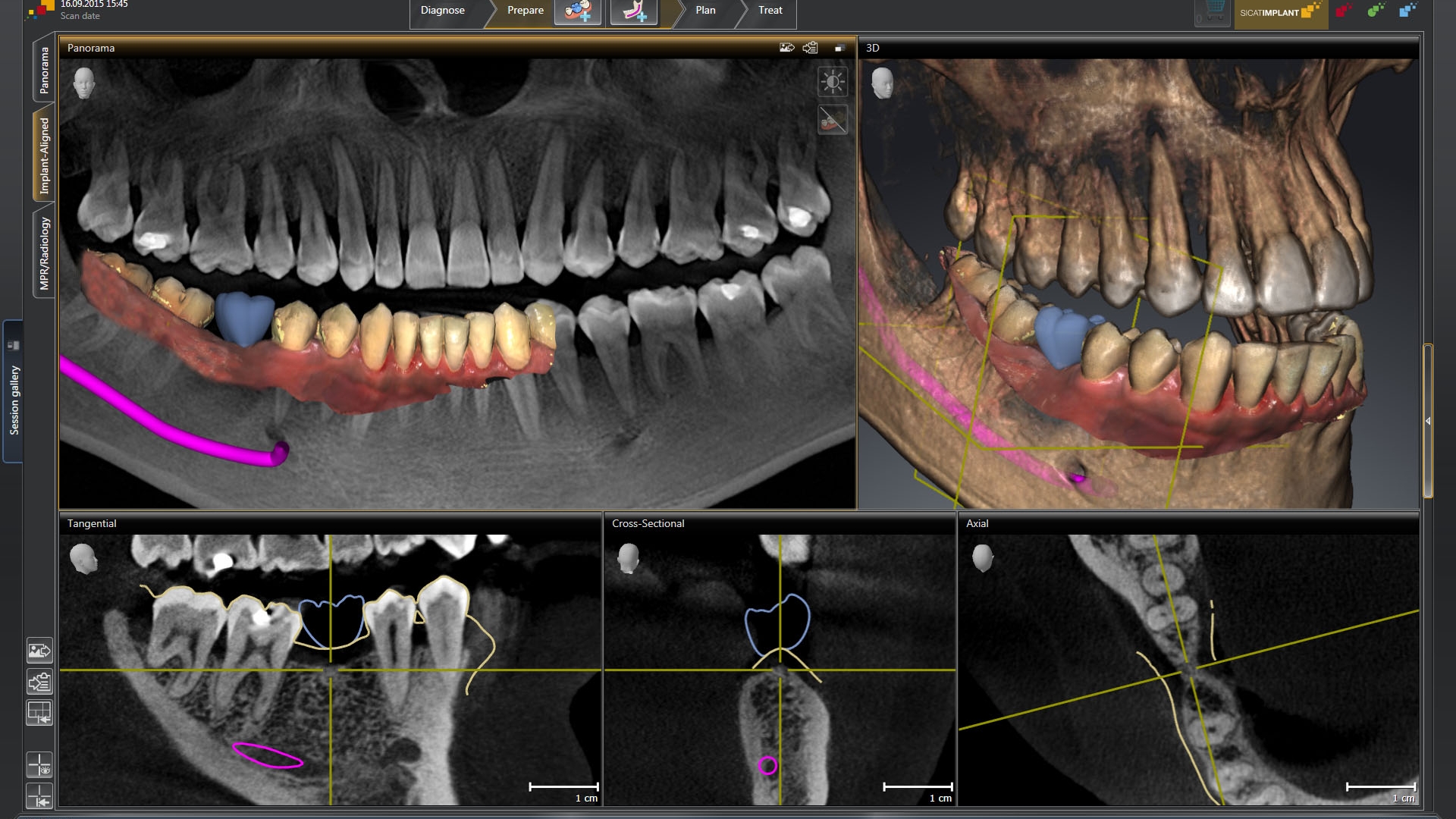 Dentsply Sirona - SiCAT Implant 2.0