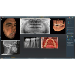 Dentsply Sirona - Sidexis 4 Uppdatering