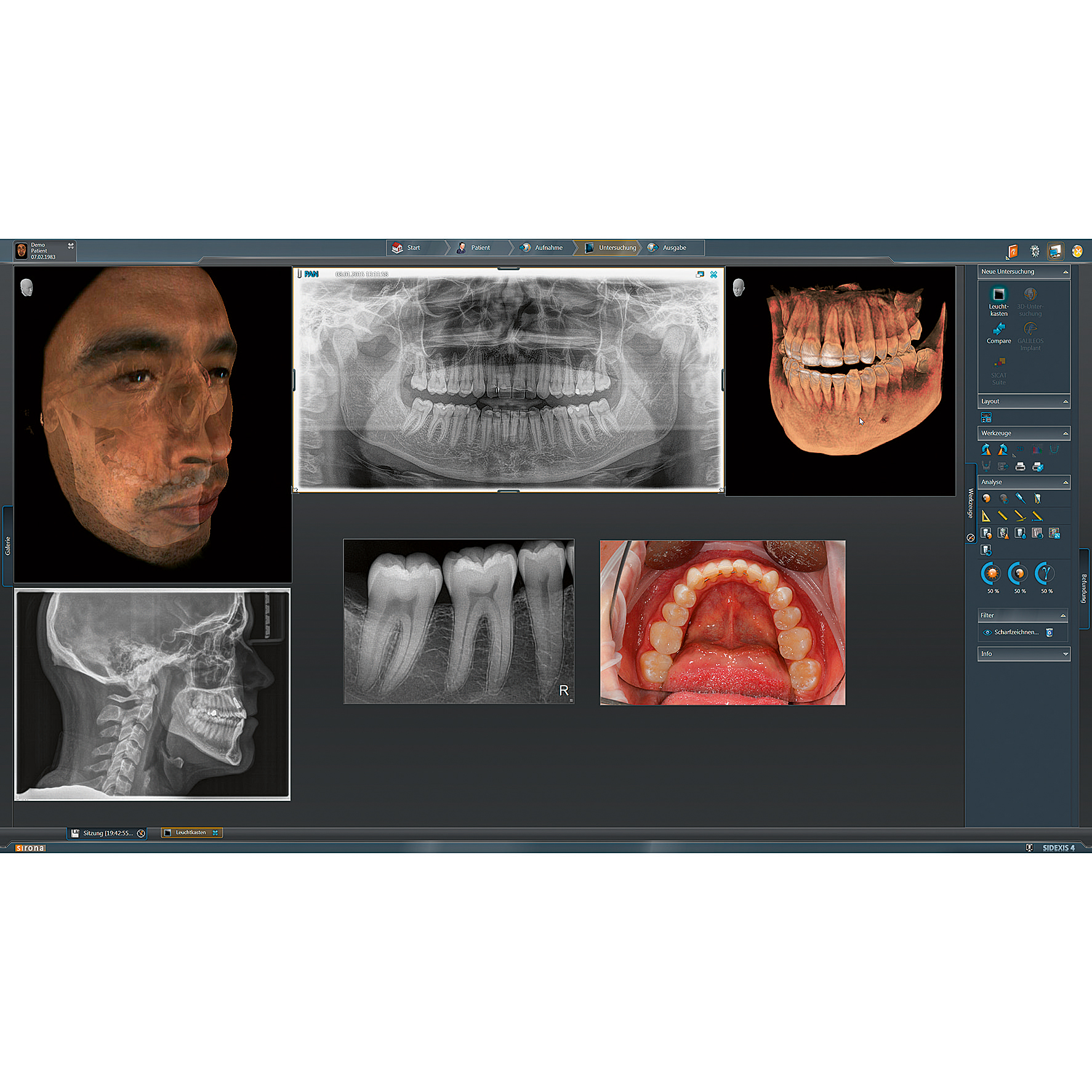 Dentsply Sirona - Sidexis 4 Uppdatering