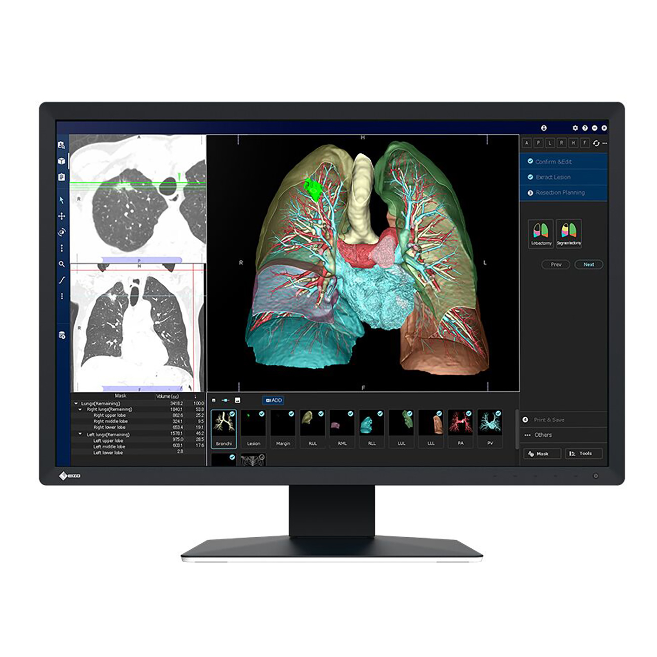 Bildskärm EIZO RadiForce - MX243W 24" 2,3 MP Svart