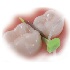 FenderPrime Lång, neongrön