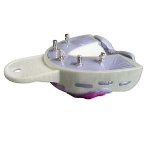 Miratray Implant S1 ök small