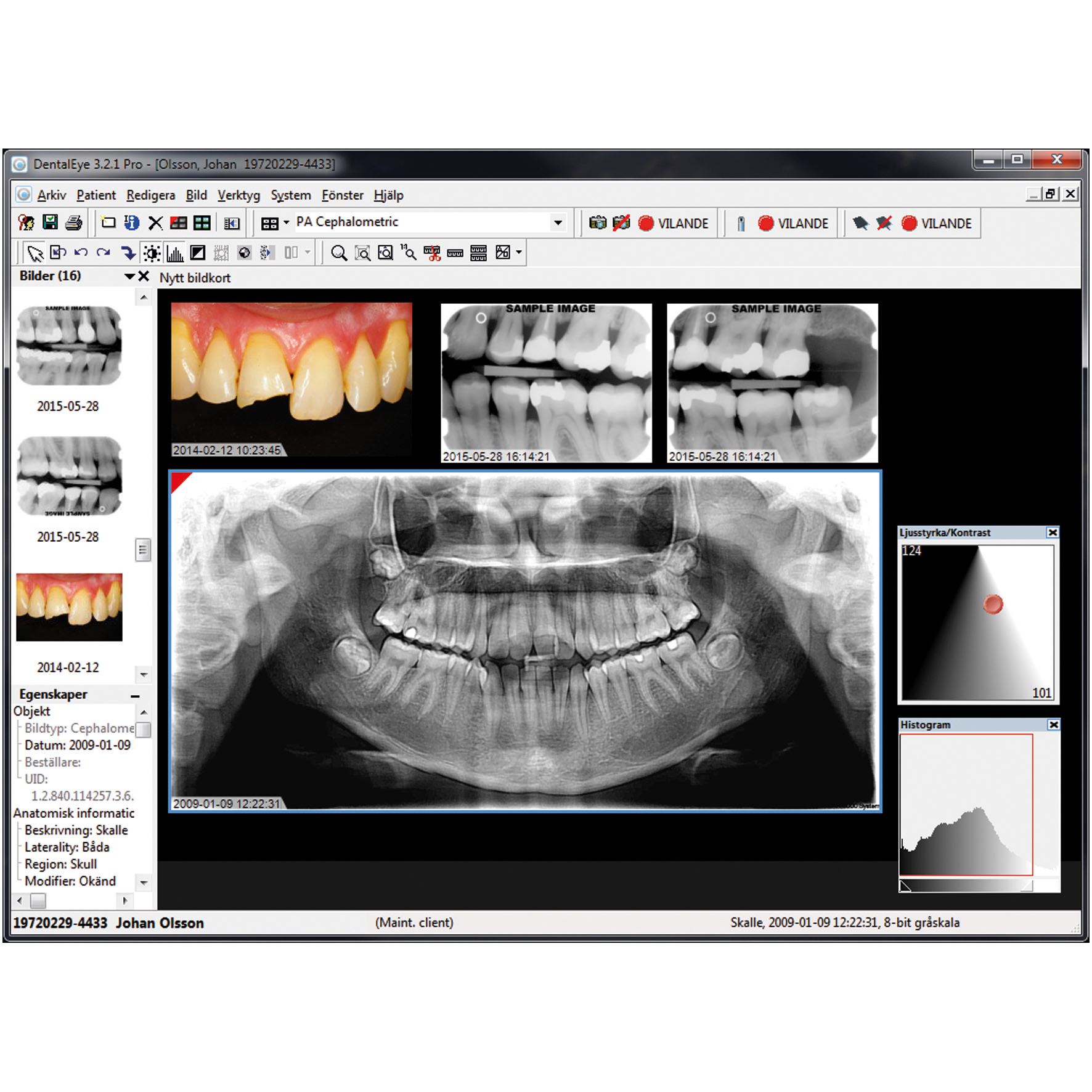 DentalEye - PRO15 Användarlicens 1 år